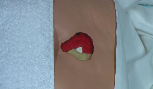 M6 V04 Staging Stage 4