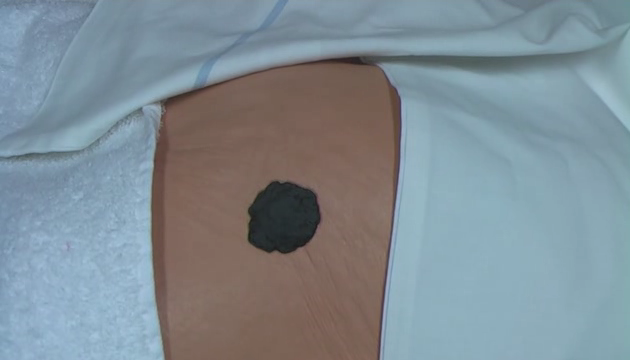 M6 V05 Staging Unstageable